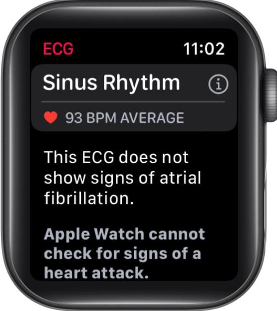 How to Take ECG with Your Apple Watch