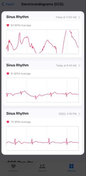 How to View ECG Results on an iPhone