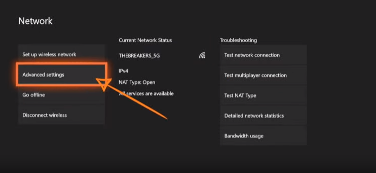How to Set a Static IP Address for Xbox One