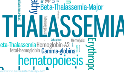 Introduction To Thalassemia – Symptoms And Dietary Recommendation